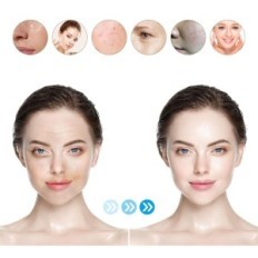 Dermapen Dr.Pen Ultima M8S Brezžična hitrost 0-2.5mm prilagoditev