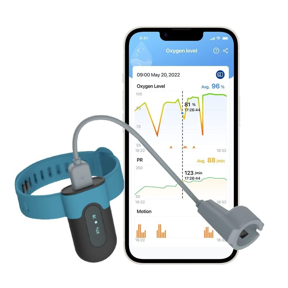 Utställning av Viatom Sleepe, och iOS och IOS med en sömnapplikation