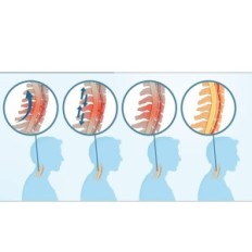 Collier col orthopédique réglable Heyouth 0327 avec airbag et support