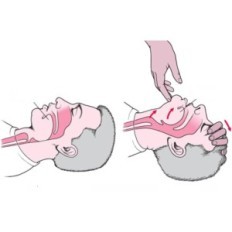 Modelo respiratorio 2 PCS. Módulo de cabeza para el ejercicio RKO XFT-E0002