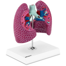 Anatomisch model 3D-man long met ziekteveranderingen