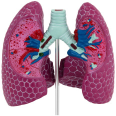 Anatomisch model 3D-man long met ziekteveranderingen