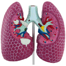 Anatomický model 3D muž plic se změnami nemoci