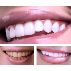 Creme dental branqueamento v34 50ml jaysuing pasta de coloração de dente reduzindo a sombra amarela para dentes mais brancos