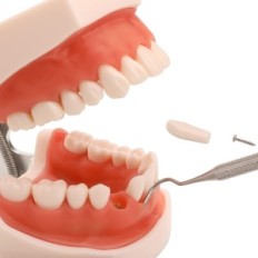 Kjeve modell med avtagbare tenner av Faruijie dental tyfodon og myke tannkjøtt, å lære for studenter