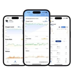 Viatom o2 ring for finger, 9.8 x 9.2 x 7.3 cm Intelligent SATTERATION monitor and sleep
